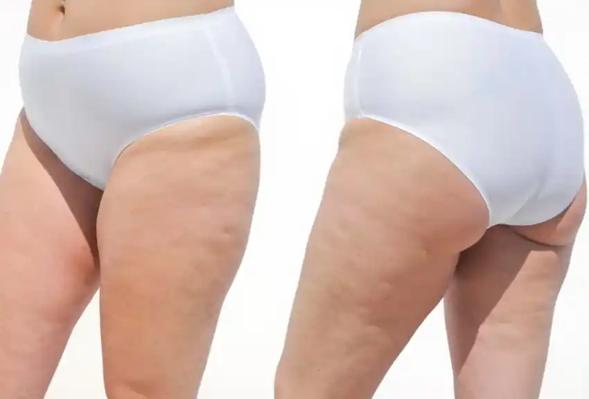 UNIVERSAL LYCRA MAXIMA CORTE LASER